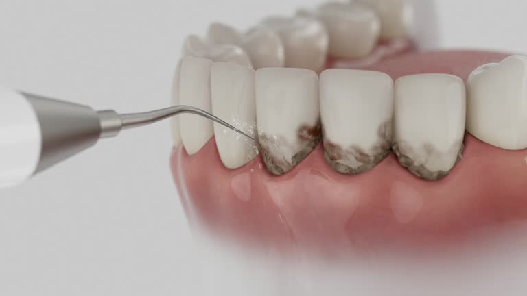 Reliable Emergency Dentist contractor in Bothell, WA by Smile Center Dentistry
